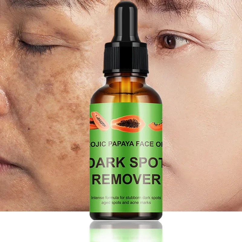 Papaya Kojic acid serum brightening anti freckles face oil serum dark spot remover. Whitening face c
